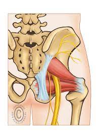 Blog post over piriformis syndroom door osteopaat Jeffrey Bursens